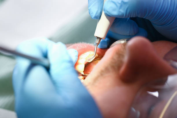 Best Emergency Dental Care for Abscessed Tooth in Parrish, AL
