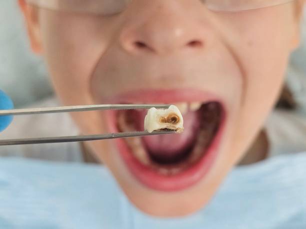 Best Weekend Emergency Dentist in Parrish, AL